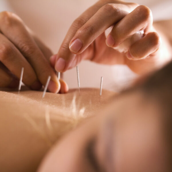 BUCHINGER Heilfasten Ganzheitliche Behandlungen Akupunktur